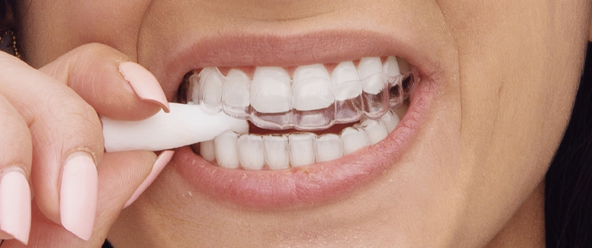 What Are Aligner Chewies Are They Necessary? (2023)